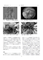 2015鹿児島県臨床外科27巻